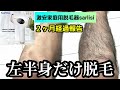 【SARLISI】２ヶ月使用正直レビュー！激安家庭用脱毛器