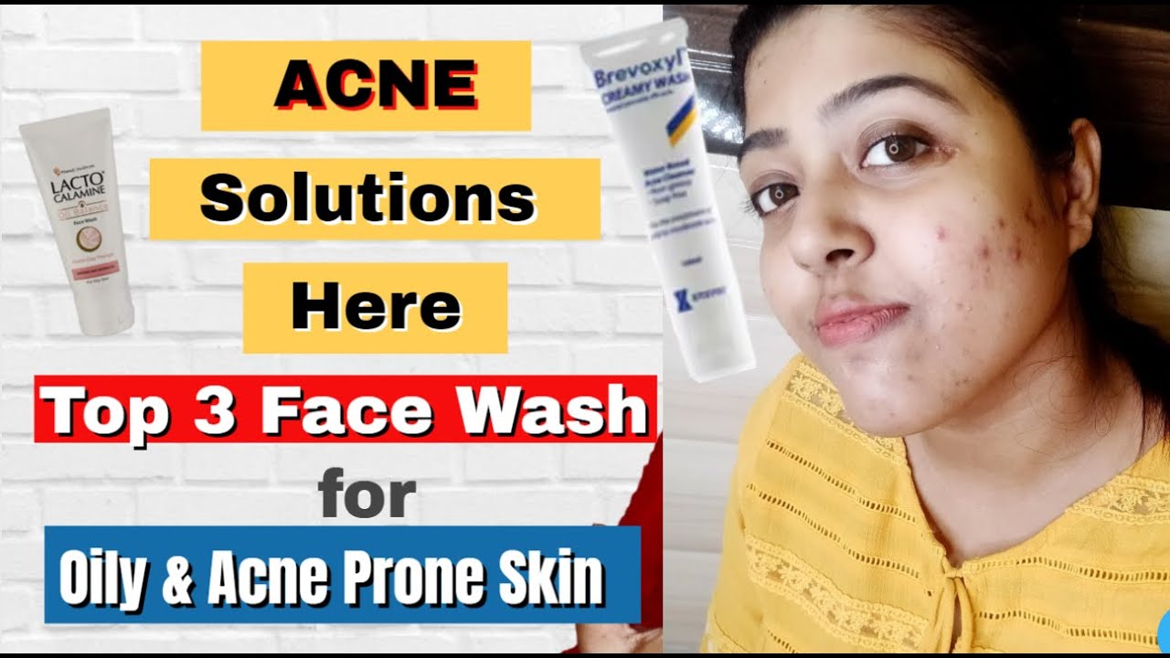 Top 3 face wash for oily acne prone skin in India Oil Control