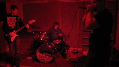 Intercranial surgery-Disfiquret boldic hooker bleeding in my trunk