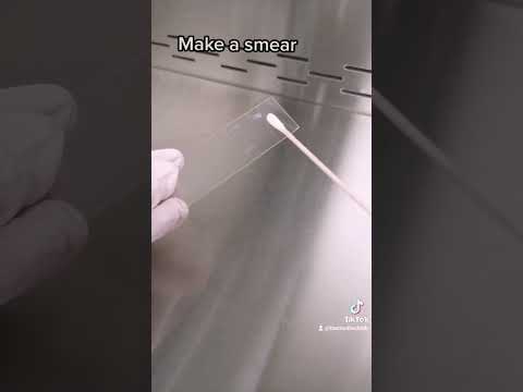 Streptococci bacteria in