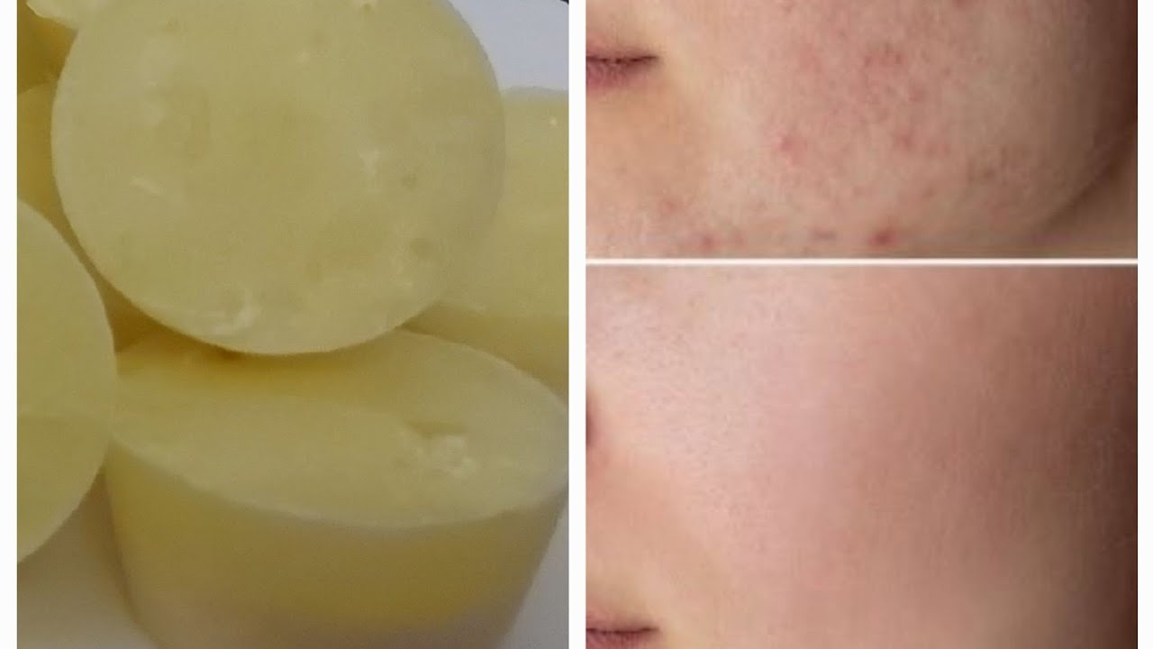 Rice ice cubes for whitening,Anti Aging,Dark Spots,Pimples,Blemishes ...