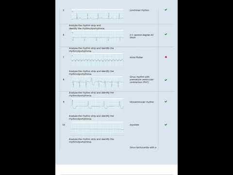 Relias Dysrhythmia Test 2023 Questions and AnswersVerified Answers