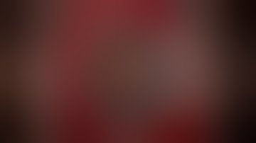 Surgery: Phacoemulsification and Goniotomy with Kahook Dual Blade