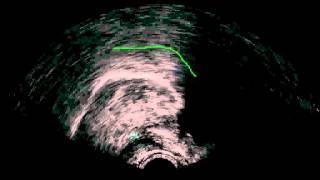 B vd uvular trill half speed.avi