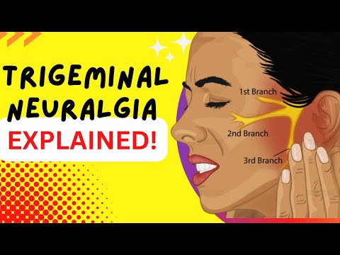 Video: Trigeminal Neurale Og MS: Hvad Er Forbindelsen?