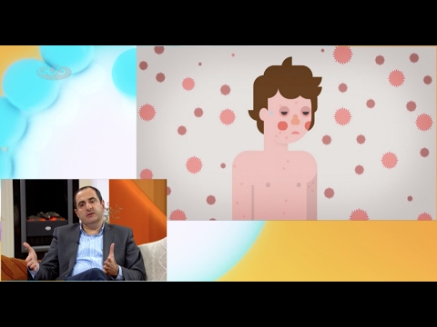 როგორ დავიცვათ თავი ვირუსებისგან | პედიატრის რჩევები