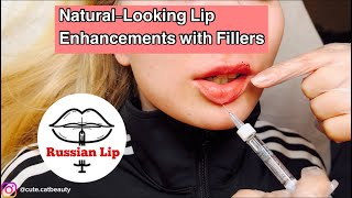 Natural Lips - Lip Filler Tutorial: Tips & Techniques