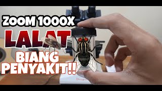 ZOOM 1000X LALAT/LALER SI BIANG PENYAKIT!!