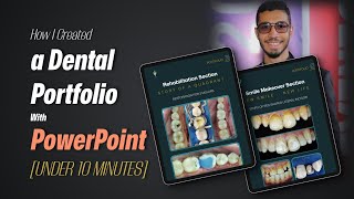 How to design your dental portfolio || Dr. Mohamed Osama