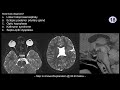 Neuroradiology board review - Pediatric Case 1