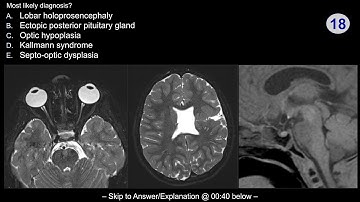 Neuroradiology board review - Pediatric Case 1