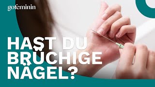 Brüchige Fingernägel: Diese 3 Tipps wirken wahre Wunder