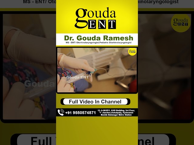 Foreign Body Bronchus in children's in Telugu | Dr Gouda Ramesh ENT Center