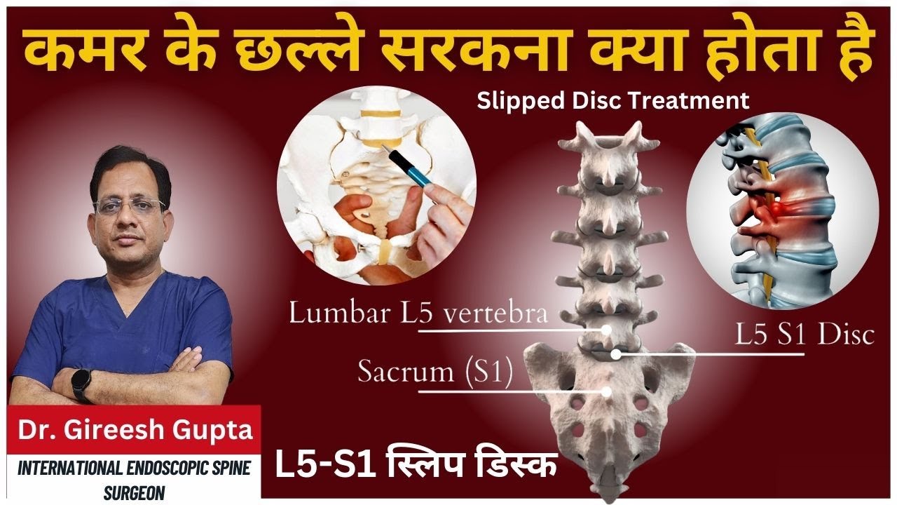 l5-s1-slip-disc-symptoms-diagnosis-aur-ilaj-ki-puri-jankari-hindi