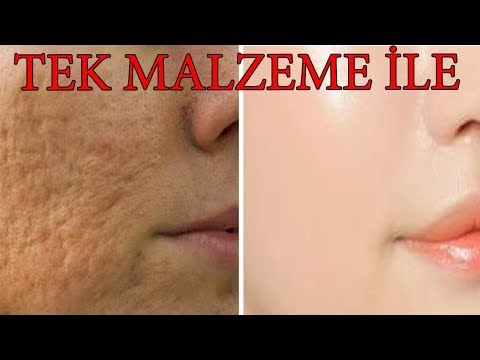 YAŞLANMAYI GECİKTİREN GENÇLEŞTİREN - LEKE GİDERECİ SIKILAŞTIRICI DOĞAL MASKE TARİFİ - GÜZELLİK BAKIM