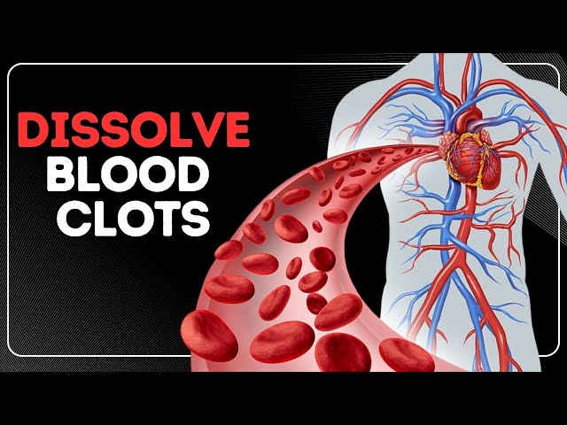 6 Vitamins To Dissolve Your Blood Clots Immediately - Youtube