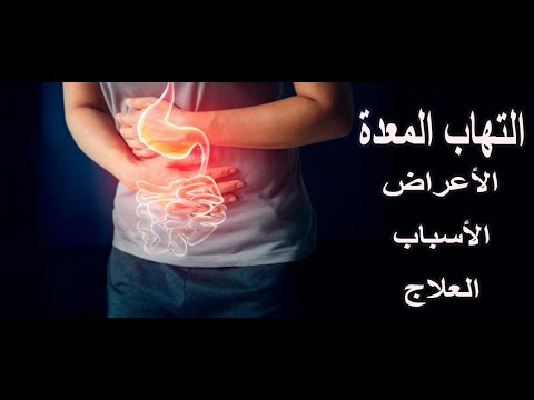 التهاب المعدة - الأعراض والأسباب و العلاج