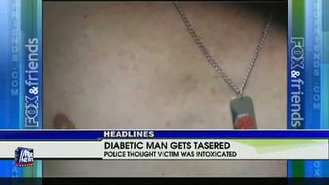 Police taser a diabetic man by mistake
