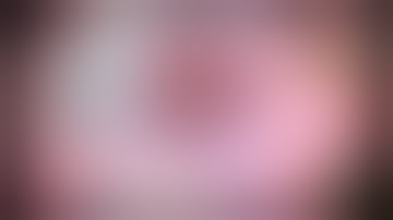 learn to master Divide-and-Conquer Cataract Surgery (Phaco Technique)