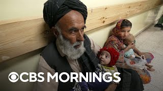 Afghanistans food crisis has accelerated under Taliban rule