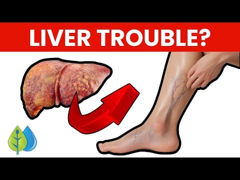 Top 8 Nutrients to UNCLOG Your Liver