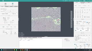How to Use Manual Cell Counting in Mosaic 3.1 | Step-by-Step Tutorial | Tucsen Microscope Camera