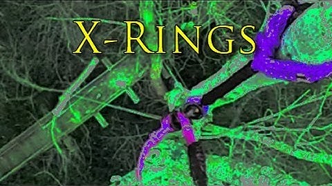 X-Rings