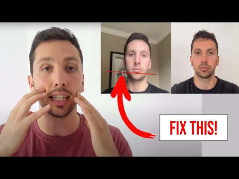 How To Fix Facial Asymmetry *2022 Update