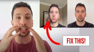 How to Fix Facial Asymmetry (for Mewing) *2022 Update