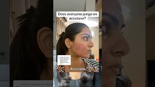 Does everyone purge on accutane? #skincare #acne #accutane #dermatology #skincareroutine