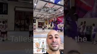 He has GIGANTISM