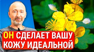 ОН лечит любые кожные болезни: папилломы, бородавки, грибок, герпес, экземы и..! Забытые рецепты.