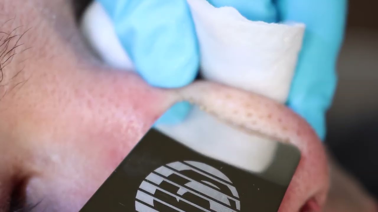 bt-micro fusion - Bio-Therapeutic | CosmoProf