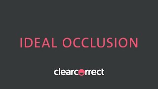 Ideal occlusion