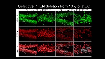 mTOR Signaling In Adult Neurogenesis & the Development of Epilepsy -  Steve C. Danzer, PHD