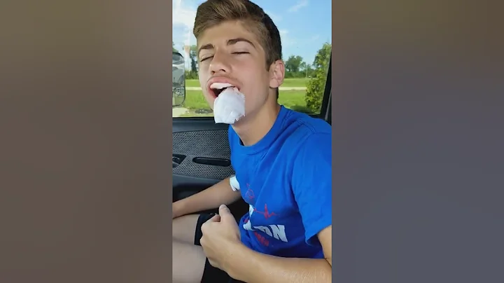 Funny Wisdom Teeth Video