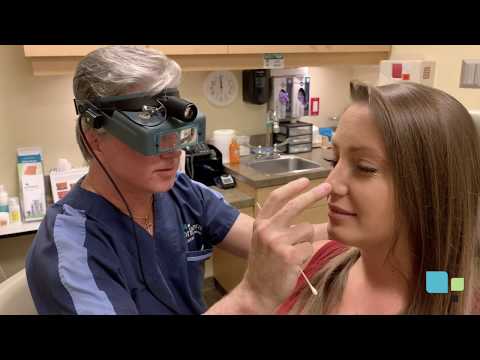 How to Clean Your Nostrils after Rhinoplasty