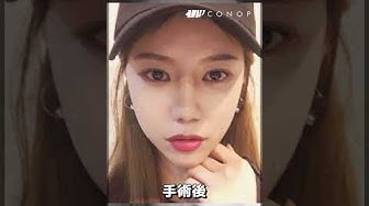 団子鼻 Youtube 団子鼻 Youtube