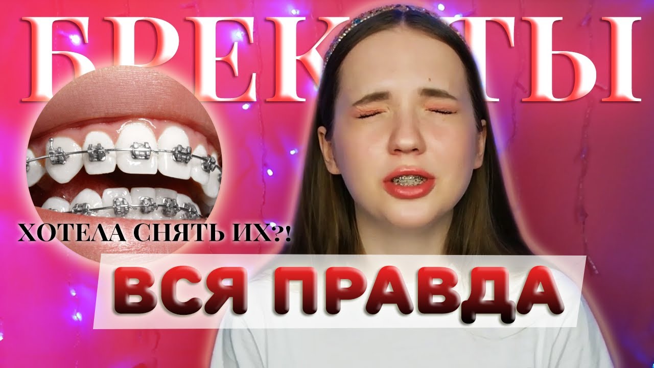 Я ХОТЕЛА СНЯТЬ БРЕКЕТЫ!!! / Вся правда о брекетах - YouTube