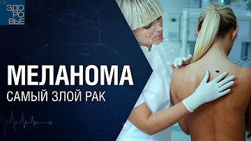 Меланома. Самый злой рак. На здоровье 28.05.2022