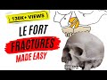 Le Fort fractures | PART ONE |