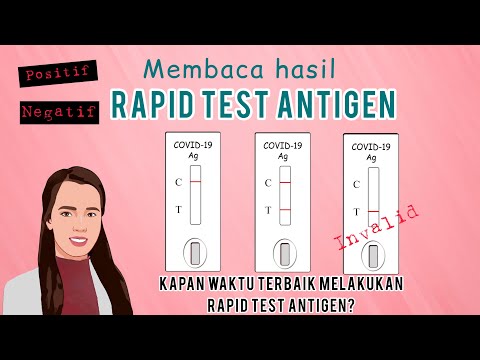 Cara membaca hasil RAPID TEST ANTIGEN / RAPID SWAB TEST