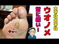飛び出るほど大きなウオノメ。常に痛みと。。。【相模原・町田巻き爪矯正センター】
