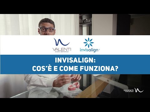 Video: Come funzionano gli allegati invisalign?