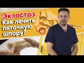 Почему болит пятка? | Экзостоз пяточной кости | Массаж при пяточной шпоре