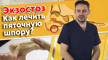 Почему болит пятка? | Экзостоз пяточной кости | Массаж при пяточной шпоре