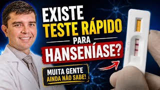 Teste rápido para hanseníase: ele funciona mesmo?