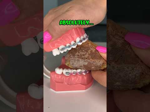 IS FREEZE DRIED CANDY SAFER FOR BRACES ORTHODONTIST REACTS JOLLY RANCHER NERDS FOOD ASMR