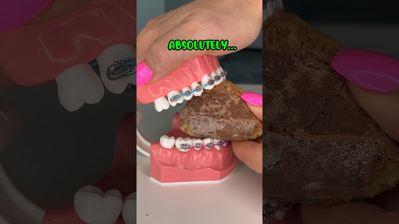 IS FREEZE DRIED CANDY SAFER FOR BRACES? 🥶🍭👀 ORTHODONTIST REACTS JOLLY
