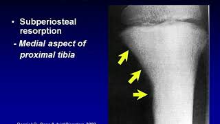 Metabolic Bone disease screenshot 2